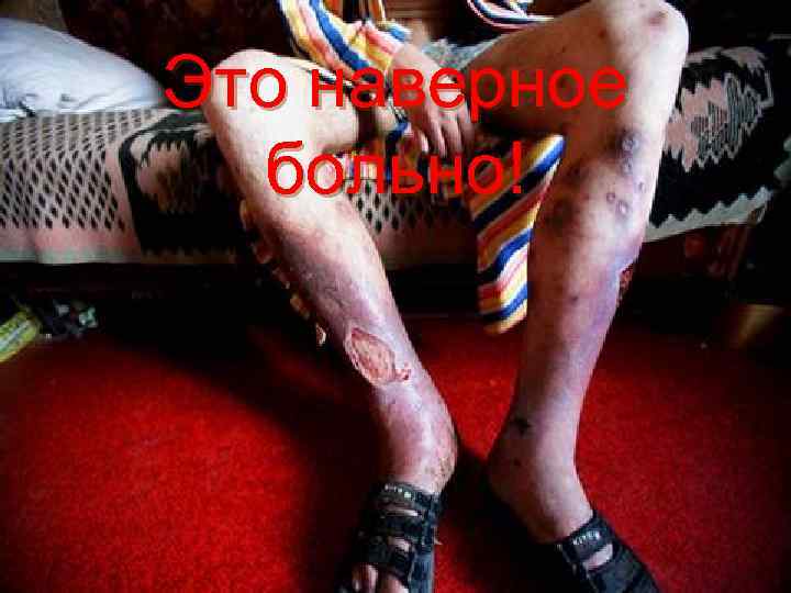 Это наверное  больно! 