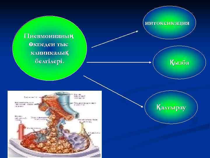     интоксикация Пневмонияның өкпеден тыс клиникалық  белгілері.   Қызба