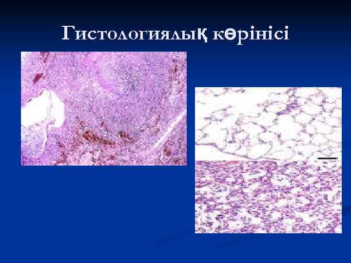 Гистологиялық көрінісі 