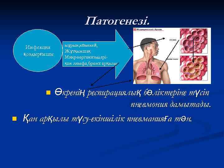     Патогенезі.  Инфекция  мұрын, көмекей,   