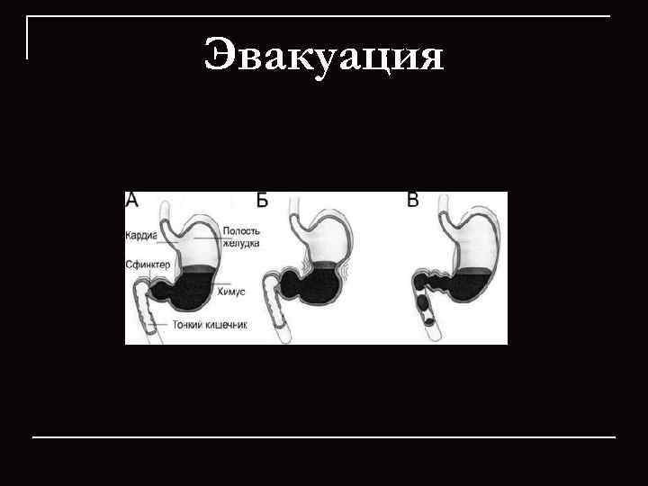 Эвакуация 