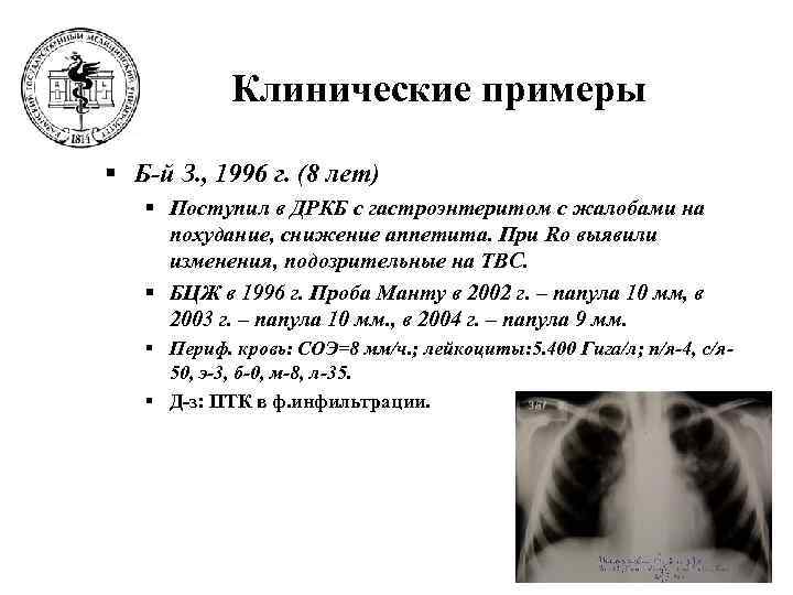   Клинические примеры § Б-й З. , 1996 г. (8 лет)  §