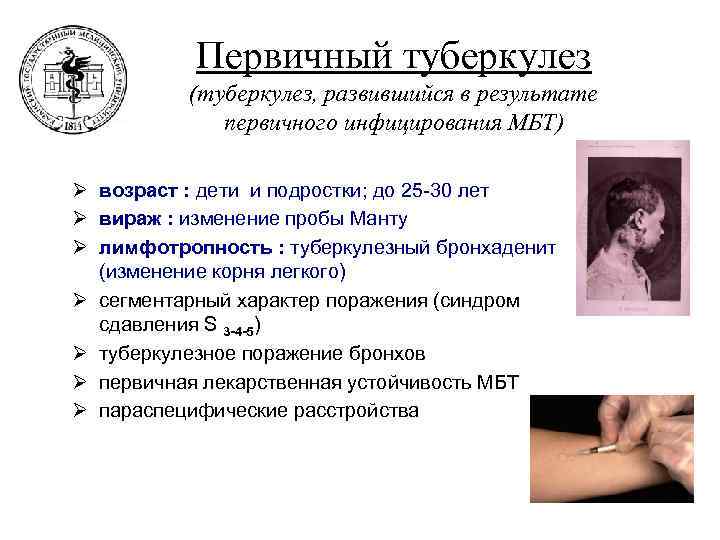   Первичный туберкулез  (туберкулез, развившийся в результате   первичного инфицирования МБТ)