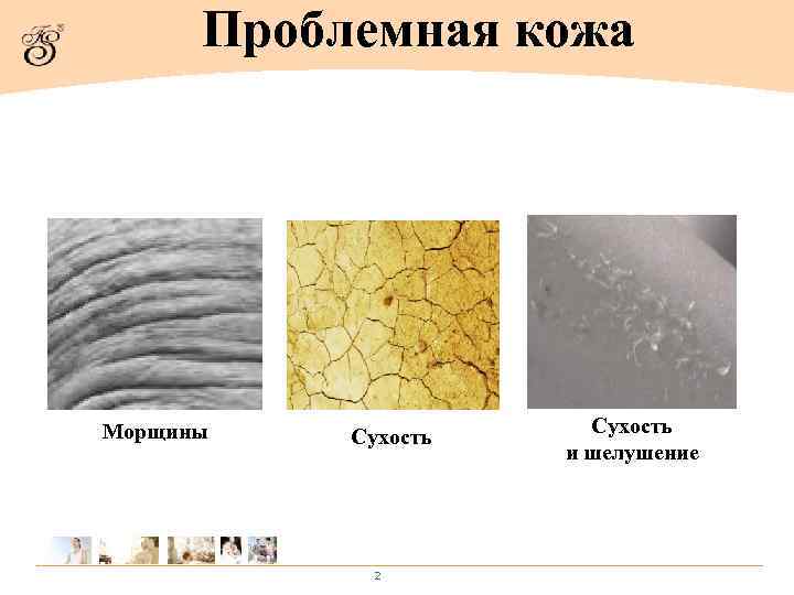  Проблемная кожа Морщины  Сухость     и шелушение  