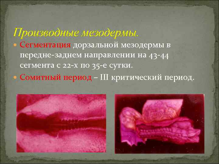 Производные мезодермы.  Сегментация дорзальной мезодермы в  передне-заднем направлении на 43 -44 