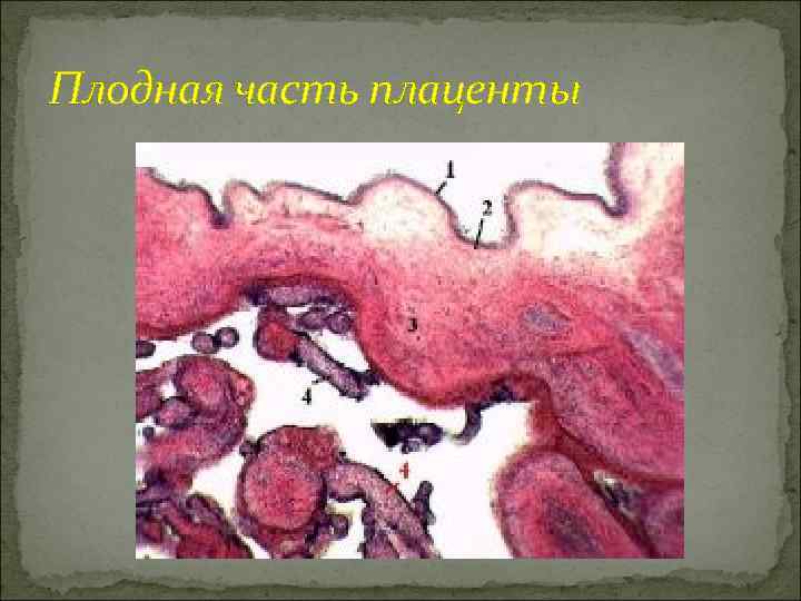 Плодная часть плаценты 