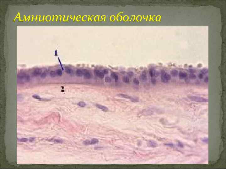 Амниотическая оболочка 