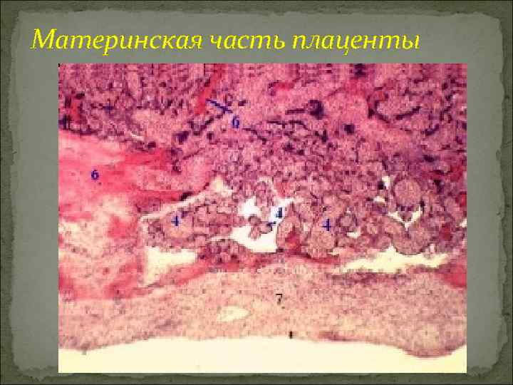 Материнская часть плаценты 