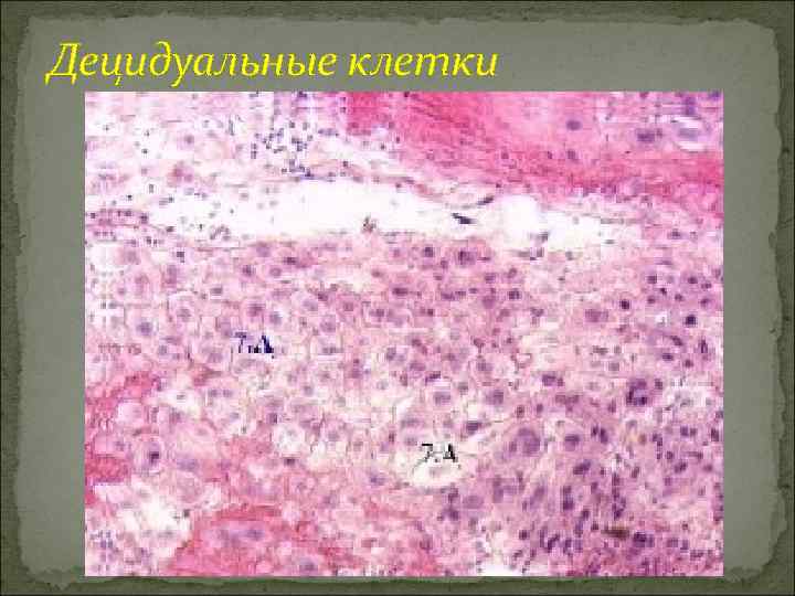 Децидуальные клетки 