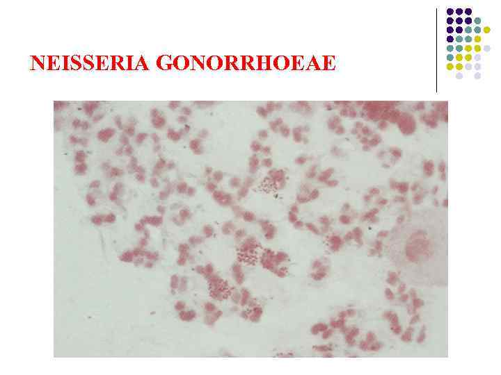 NEISSERIA GONORRHOEAE 