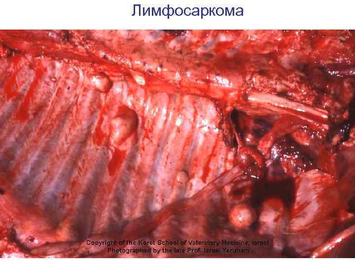 Лимфосаркома 