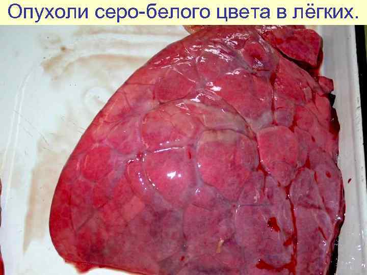 Опухоли серо-белого цвета в лёгких. 