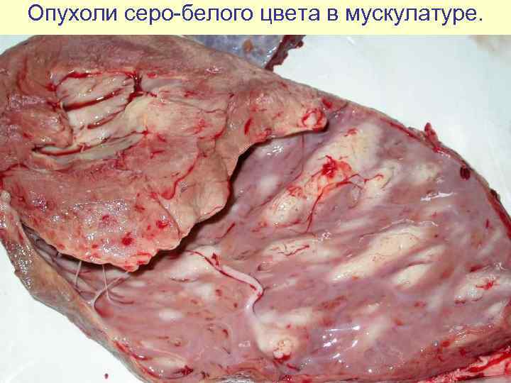 Опухоли серо-белого цвета в мускулатуре. 