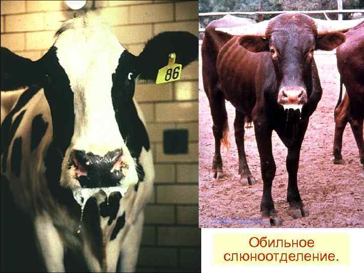   Обильное слюноотделение. 