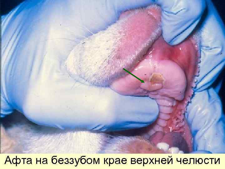 Афта на беззубом крае верхней челюсти 