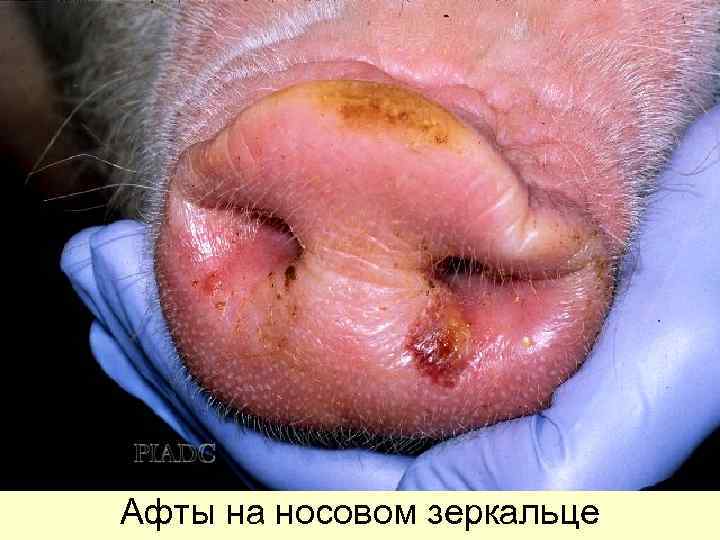 Афты на носовом зеркальце 