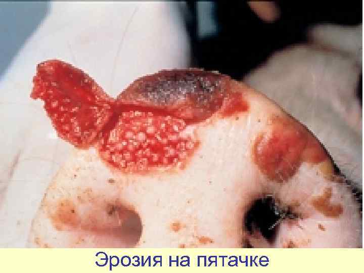 Эрозия на пятачке 