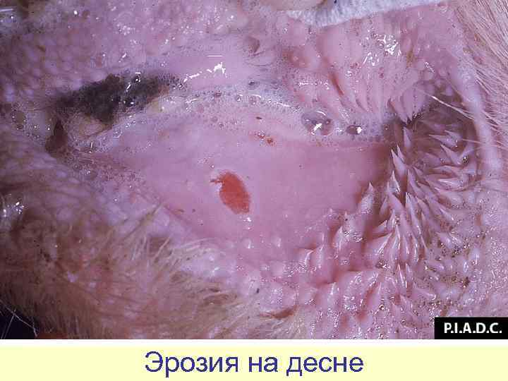 Эрозия на десне 