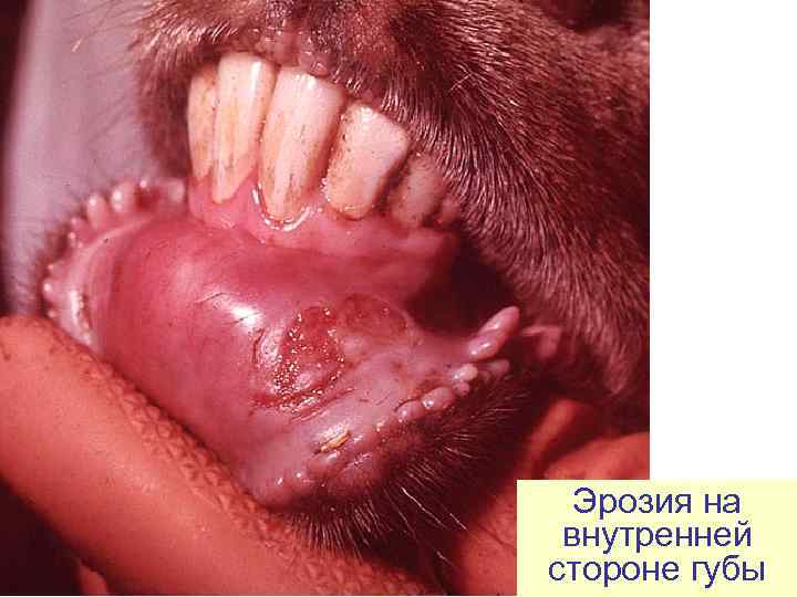  Эрозия на  внутренней стороне губы 