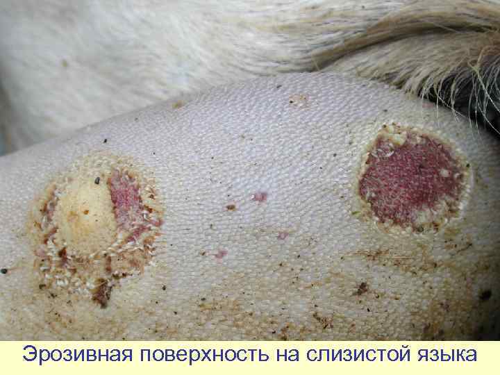 Эрозивная поверхность на слизистой языка 