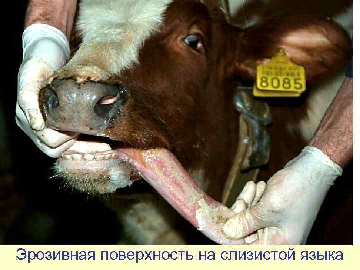 Эрозивная поверхность на слизистой языка 