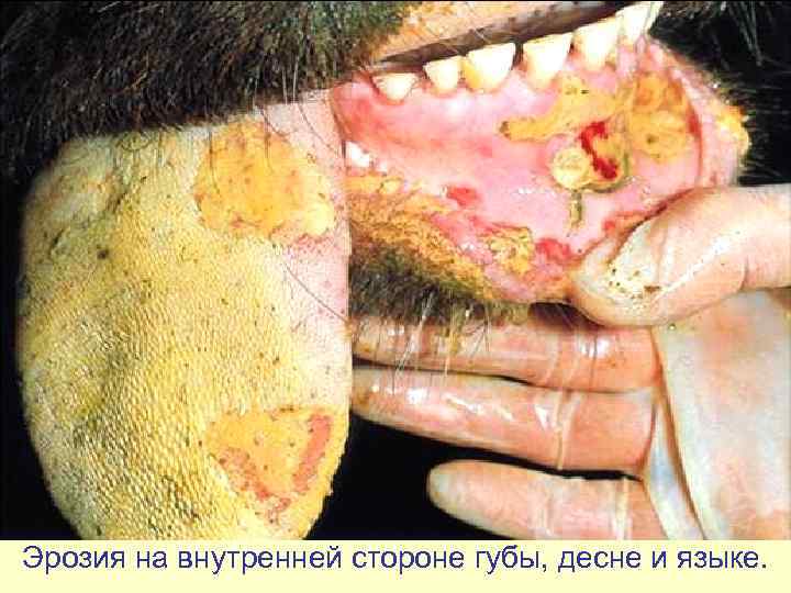 Эрозия на внутренней стороне губы, десне и языке. 