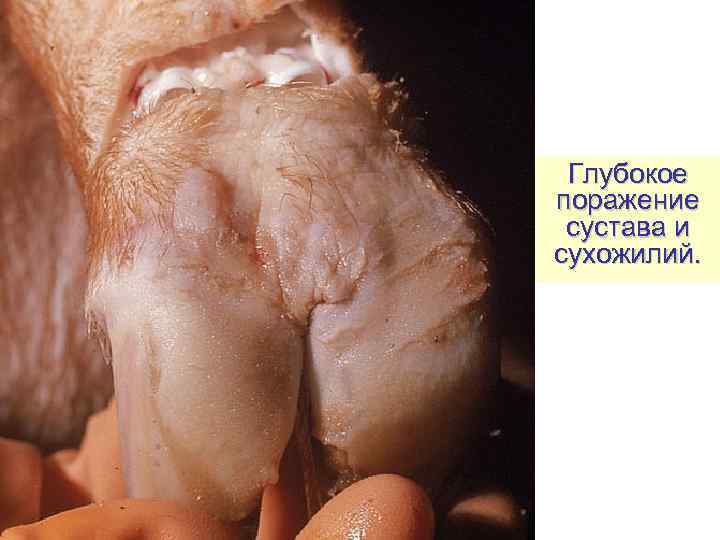  Глубокое поражение  сустава и сухожилий. 