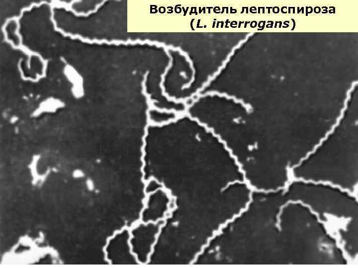 Возбудитель лептоспироза (L. interrogans) 