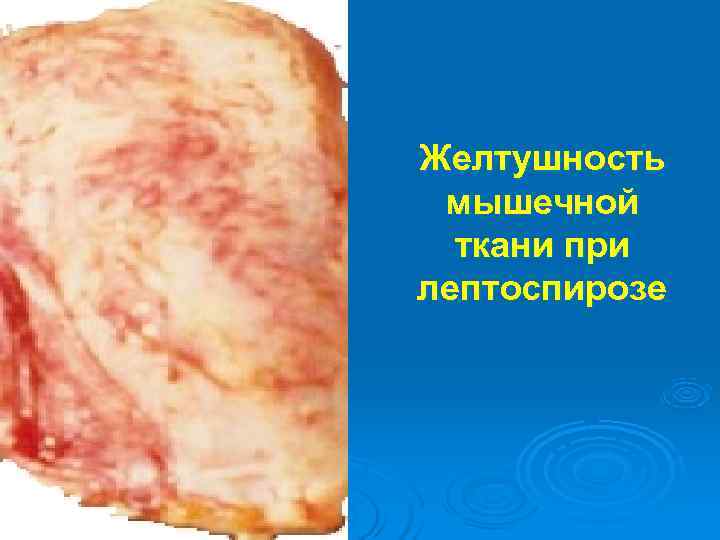 Желтушность мышечной  ткани при лептоспирозе 