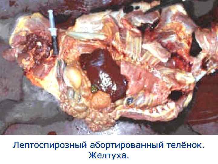 Лептоспирозный абортированный телёнок.   Желтуха. 