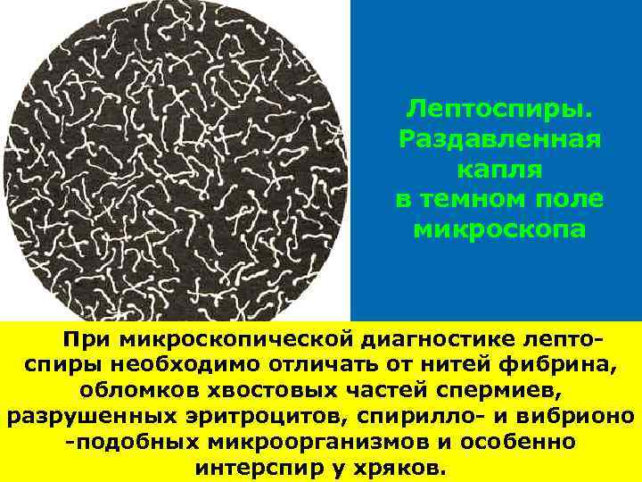       Лептоспиры.     Раздавленная  