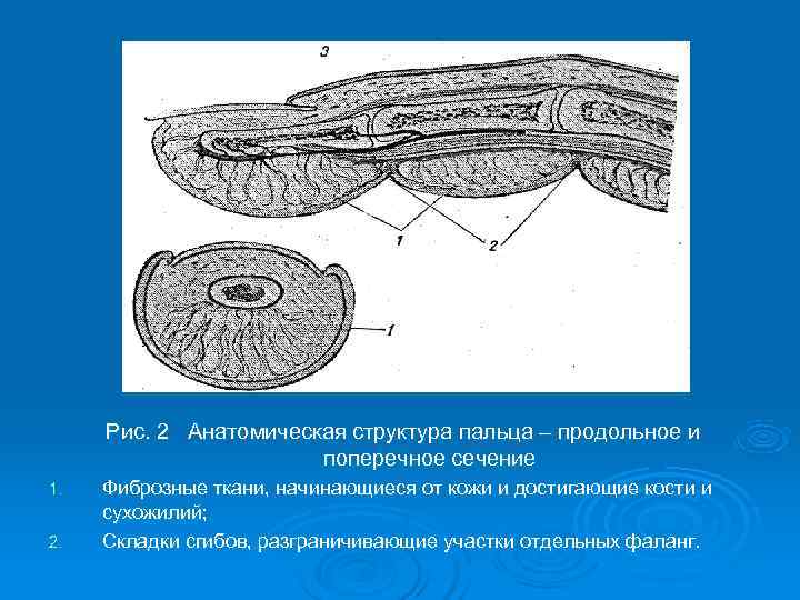  Рис. 2 Анатомическая структура пальца – продольное и    поперечное сечение