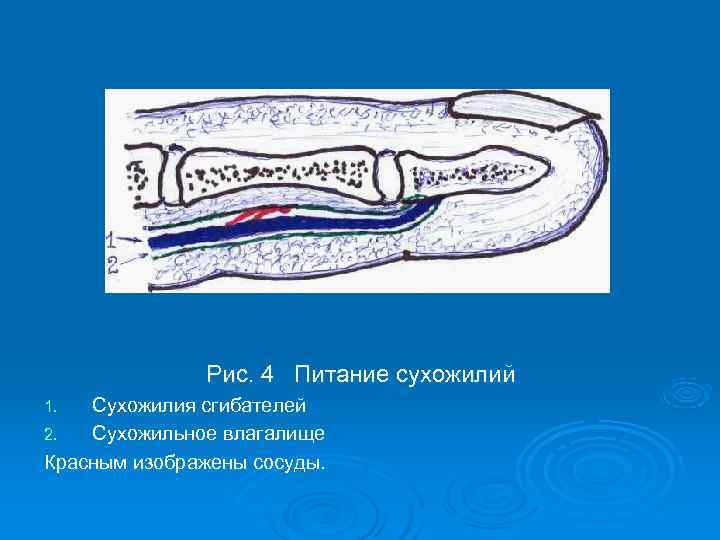    Рис. 4 Питание сухожилий 1.  Сухожилия сгибателей 2.  Сухожильное