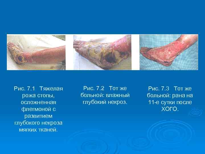 Рис. 7. 1 Тяжелая Рис. 7. 2 Тот же  Рис. 7. 3 Тот