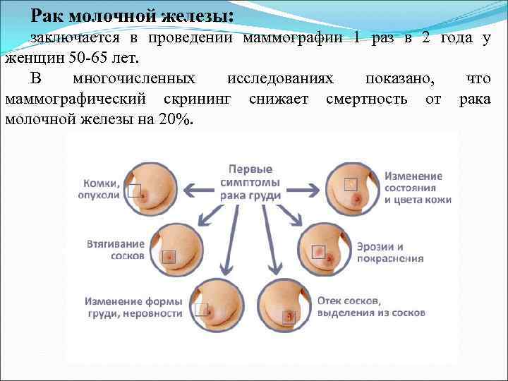   Рак молочной железы: заключается в проведении маммографии 1 раз в 2 года