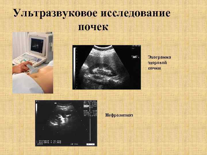 Исследование почек. УЗИ. Здоровая почка на УЗИ. УЗИ исследование почек. Ориентация датчика при УЗИ.