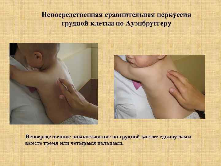 Непосредственная сравнительная перкуссия  грудной клетки по Ауэнбруггеру Непосредственное поколачивание по грудной клетке