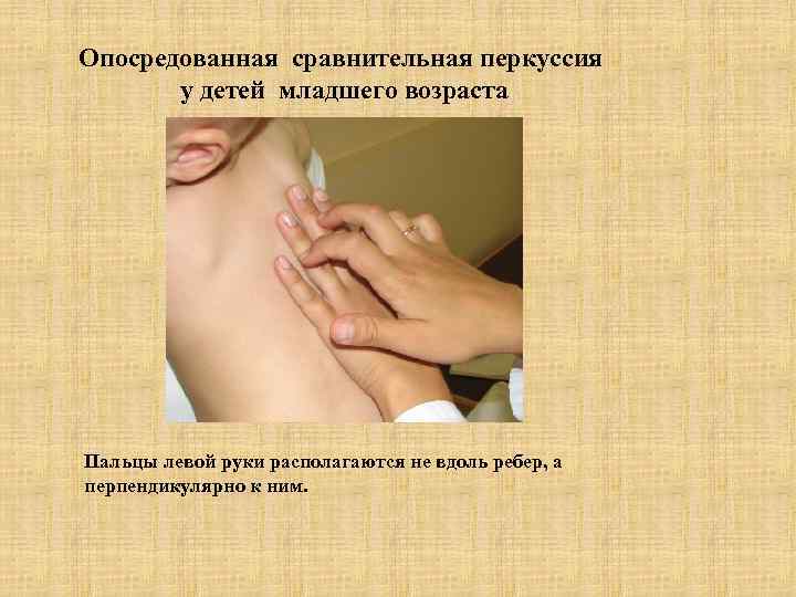 Опосредованная сравнительная перкуссия  у детей младшего возраста Пальцы левой руки располагаются не вдоль