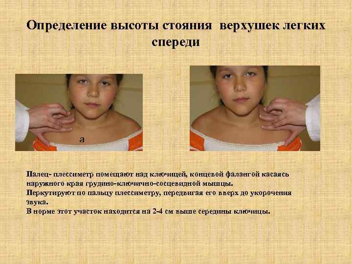 Определение высоты стояния верхушек легких   спереди   а  Палец- плессиметр