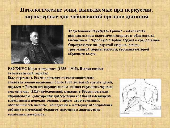  Патологические зоны, выявляемые при перкуссии,   характерные для заболеваний органов дыхания 