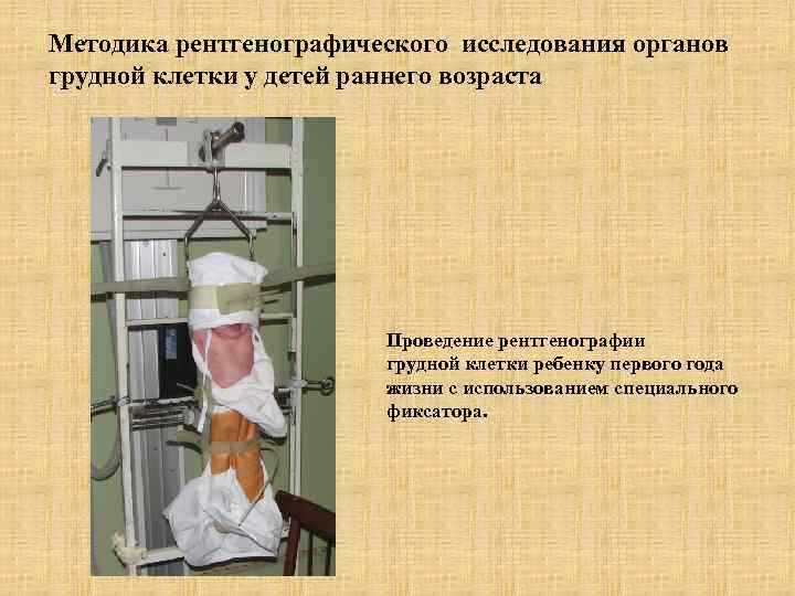 Методика рентгенографического исследования органов грудной клетки у детей раннего возраста    