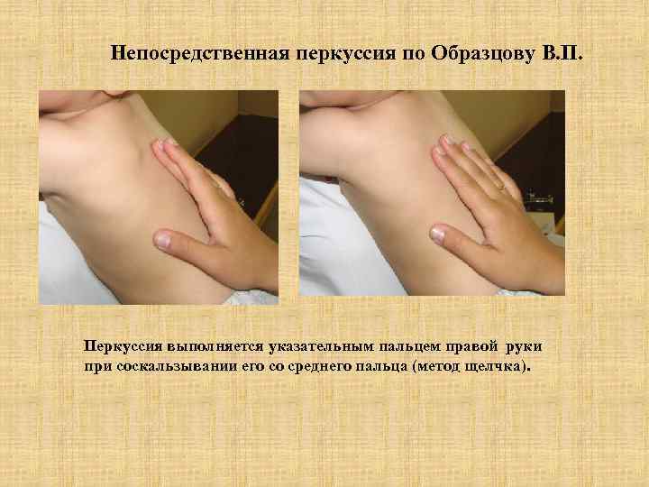   Непосредственная перкуссия по Образцову В. П. Перкуссия выполняется указательным пальцем правой руки