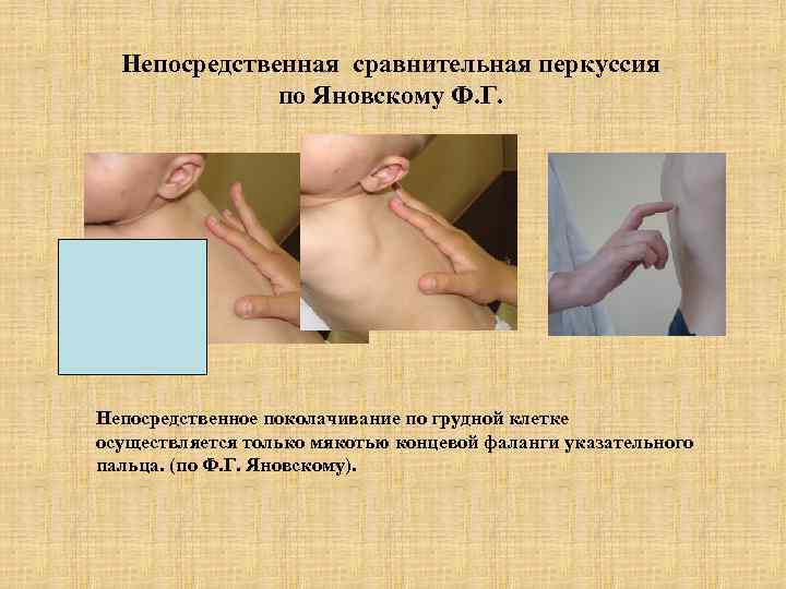  Непосредственная сравнительная перкуссия    по Яновскому Ф. Г. Непосредственное поколачивание по