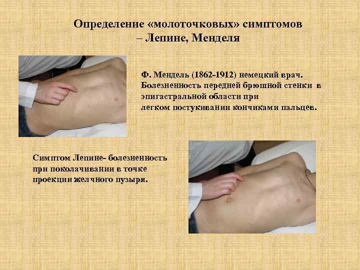 Определение «молоточковых» симптомов – Лепине, Менделя Ф. Мендель (1862 -1912) немецкий врач. Болезненность передней