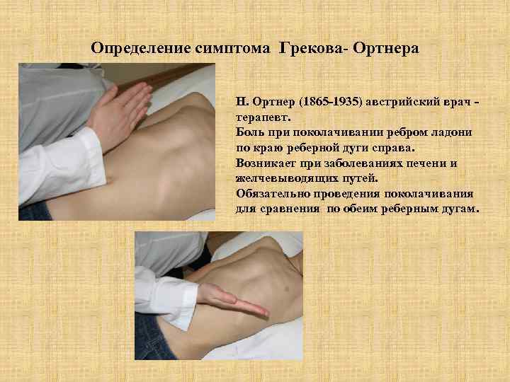 Определение симптома Грекова- Ортнера Н. Ортнер (1865 -1935) австрийский врач терапевт. Боль при поколачивании