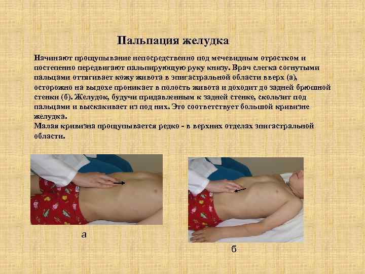 Пальпация желудка Начинают прощупывание непосредственно под мечевидным отростком и постепенно передвигают пальпирующую руку книзу.