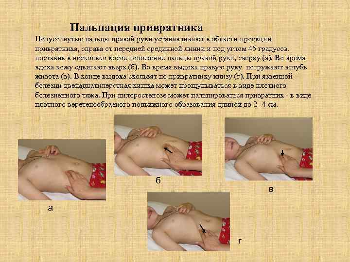 Пальпация привратника Полусогнутые пальцы правой руки устанавливают в области проекции привратника, справа от передней