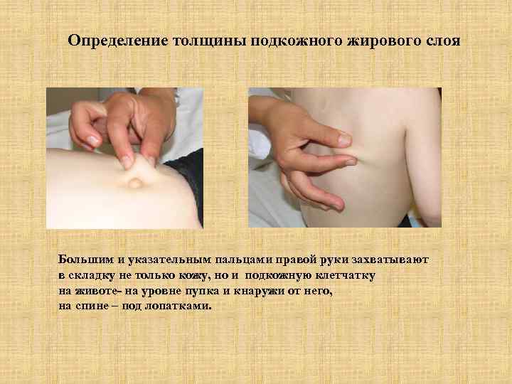  Определение толщины подкожного жирового слоя Большим и указательным пальцами правой руки захватывают в
