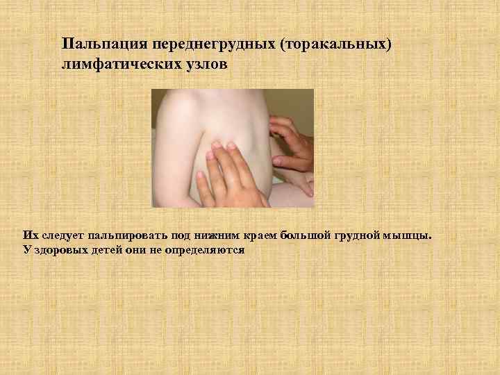  Пальпация переднегрудных (торакальных)  лимфатических узлов Их следует пальпировать под нижним краем большой