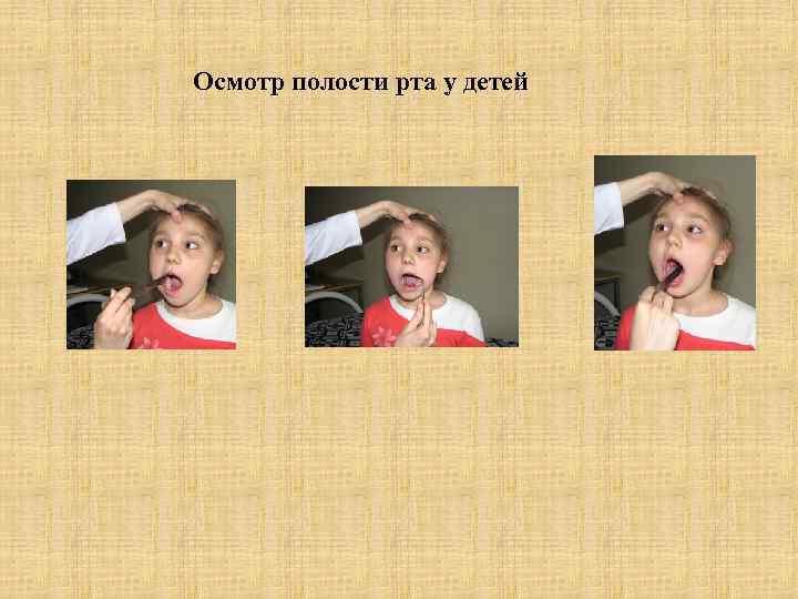 Осмотр полости рта у детей 